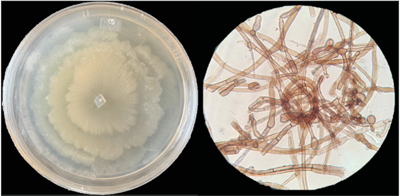 Microorganismo endófito en un entorno realista bajo microscopio, mostrando detalles de su estructura y relación con los tejidos vegetales